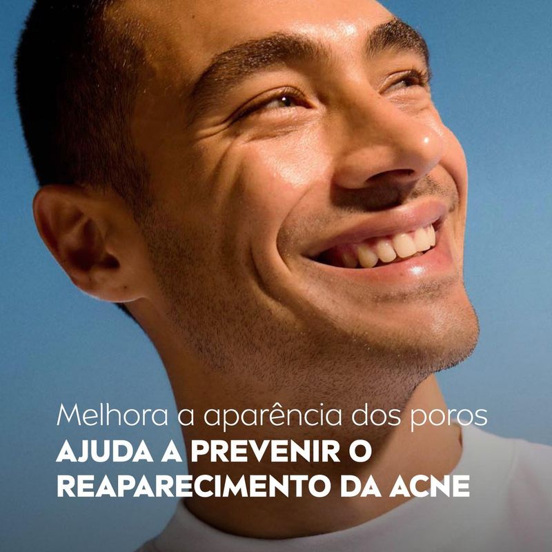 4005900945709-NIVEASaboneteFacialemGelAcneControl150g-2.jpg