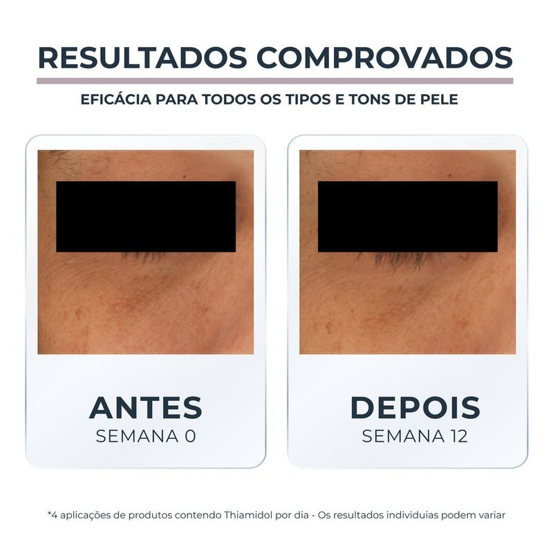 4005900998385-EucerinAnti-pigmentClareadorCremeFacialOlhos15ml-4.jpg