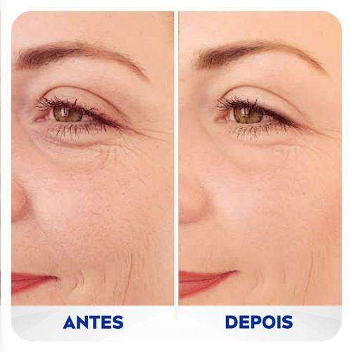 Nivea Preenchedor Q10 Expert Antissinais 15ml